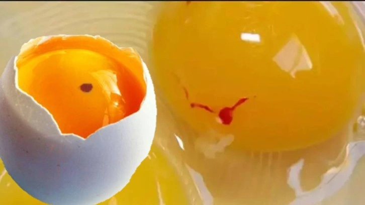 Gözünüzden kaçıyor olabilir: Lekeli yumurtayı tüketmeden önce bir daha düşünün