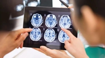 Araştırmacılar, Parkinson'u üç dakikada tespit etmeye çalışıyor