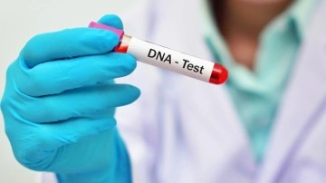 DNA testiye gelen 186 milyonluk miras