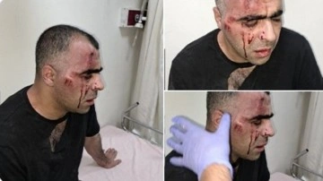 Gazeteci Sinan Aygül'e saldırmışlardı. Polis memuru ile belediye çalışanı tutuklandı