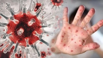 Yeni salgın paniği Çin'e sıçradı. Maymun virüsü ilk kez Çin ana karasında...